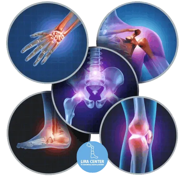 Cuidado integral de las articulaciones y la movilidad: ilustración anatómica de mano, hombro, cadera, tobillo y rodilla con emblema de Lira Center