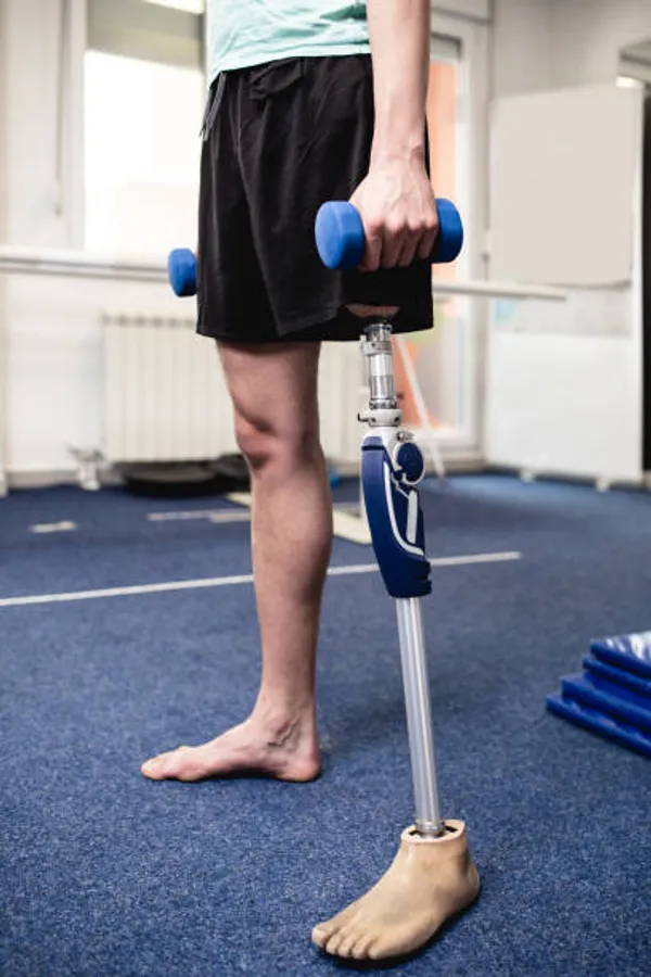 Paciente de pie entrenando equilibrio y fuerza con prótesis transfemoral durante la readaptación a la marcha — Prótesis personalizadas
